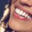 Love a Hollywood Smile but worried about the cost?